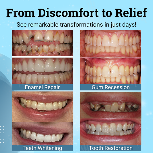 AEXZR® Non-Surgical Gum "Suture" Gel