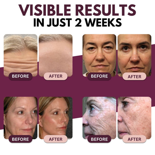 AEXZR® Calcium Volume Multi Balm