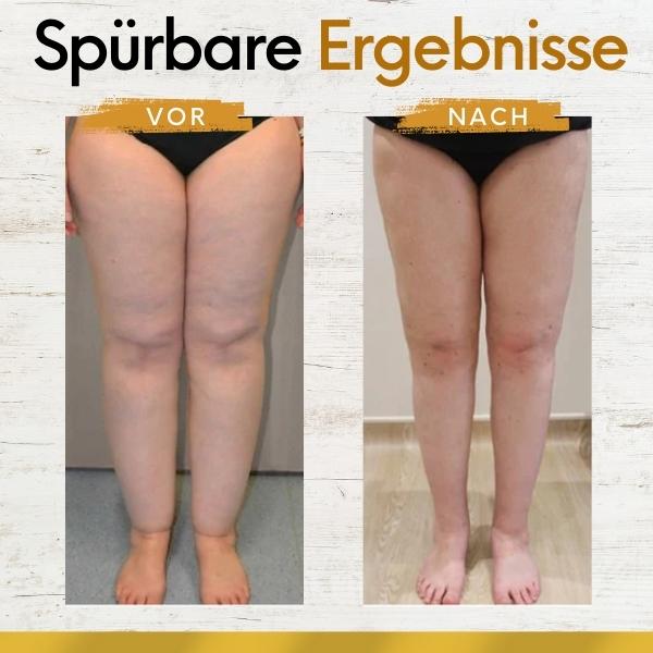 AEXZR™ Lymphdrainage Entgiftende Salbe