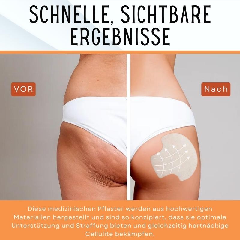 AEXZR™ Butt-Lift-Formungspads