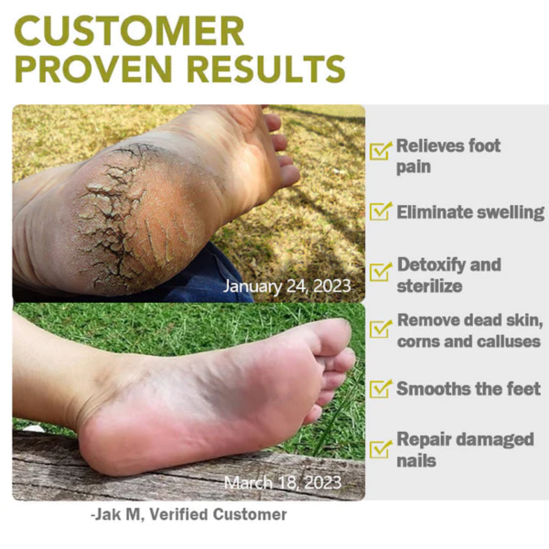 AEXZR™ Foot Medication Effervescent Pills (Limited stock🔥)