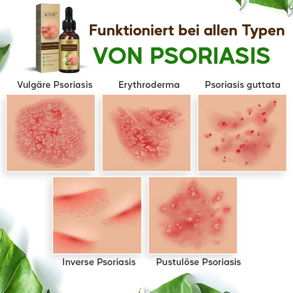 AEXZR™ Psoriasis Heilung Ätherisches Öl