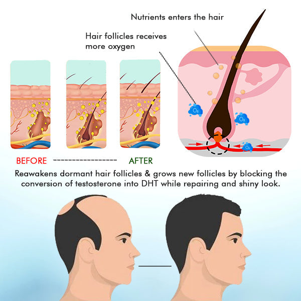 AEXZR™ Scalp & Hair Revive