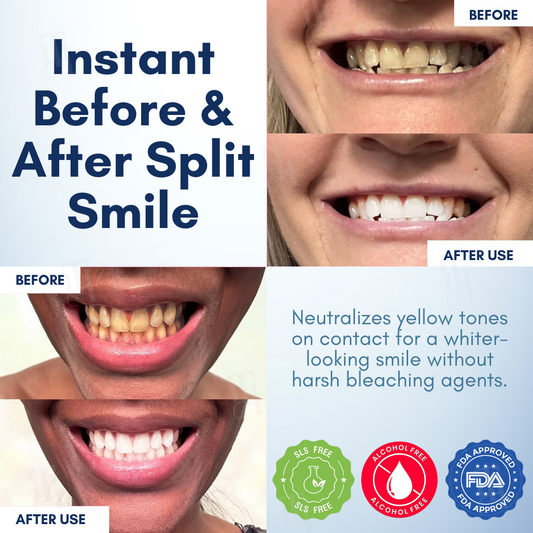 AEXZR® Pro-Bright Teeth Gloss - Instant Radiant Smile