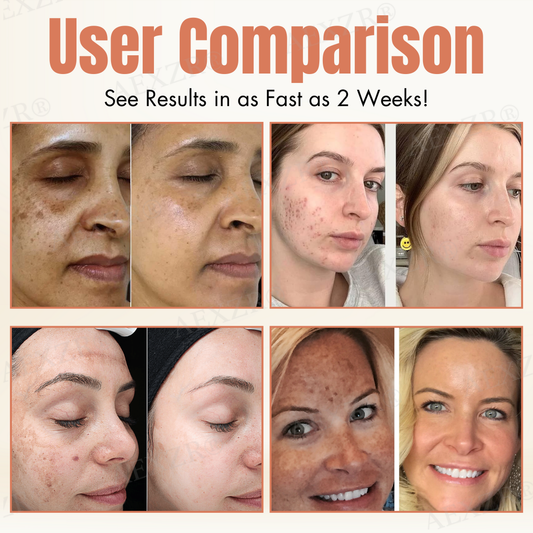 AEXZR® Melanin Correcting Facial Serum