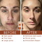 AEXZR® Herbal Spots Peel-Off Facial Mask