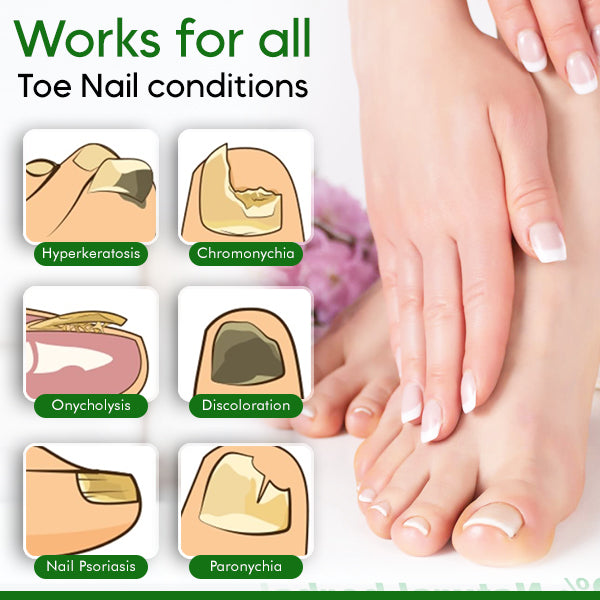 AEXZR™ Toe Nail Treatment Gel