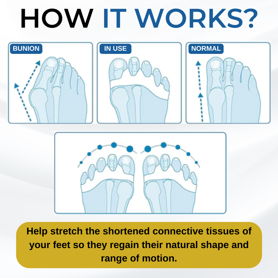 AEXZR™ Silicone Bunion Corrector