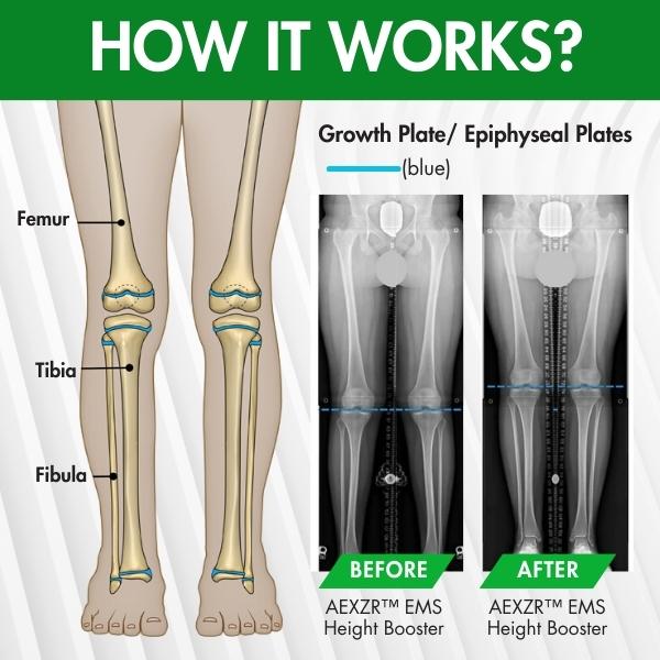 AEXZR EMS Height Booster