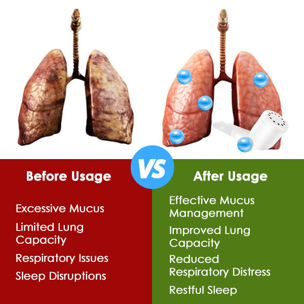 AEXZR™ Lung Care & Mucus Remover Device